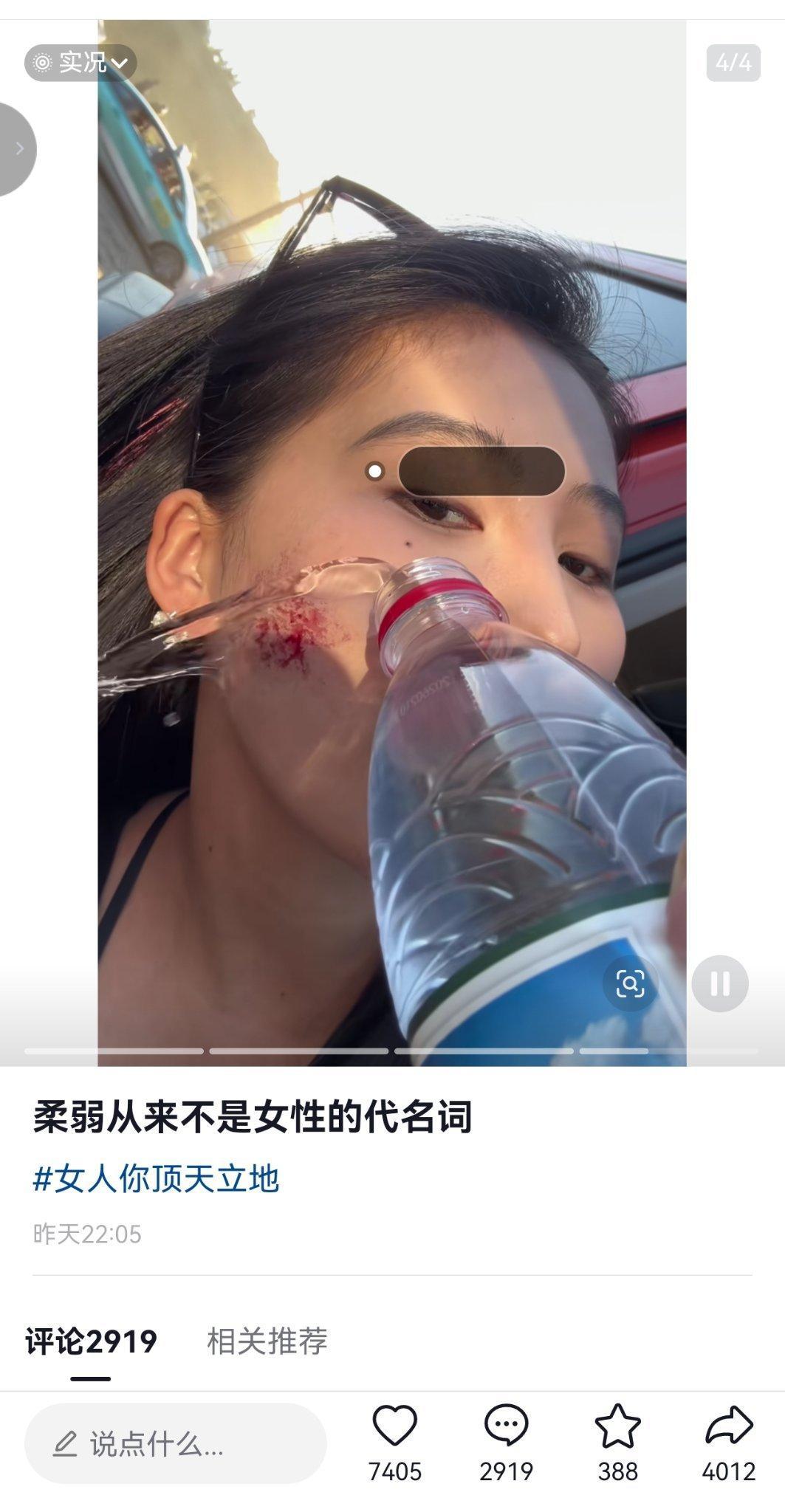 我的天，她真的好勇敢 