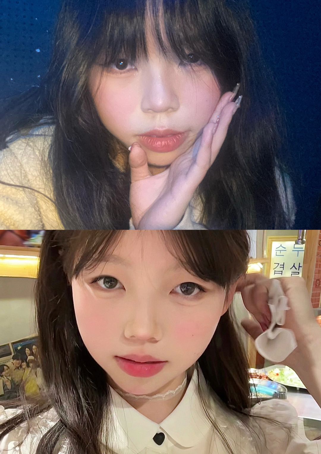 戴牙套的这些日子，我经历了什么？