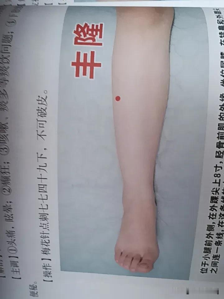 哪些穴位与祛湿、健脾相关? 与祛湿、健脾相关的穴位还挺多。像丰隆穴，它是足阳明胃