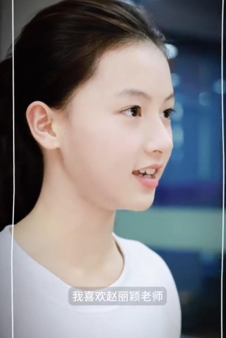 素人走红女孩七七喜欢赵丽颖！
因为长得像张柏芝走红，于正要签她被她拒绝，后来签了