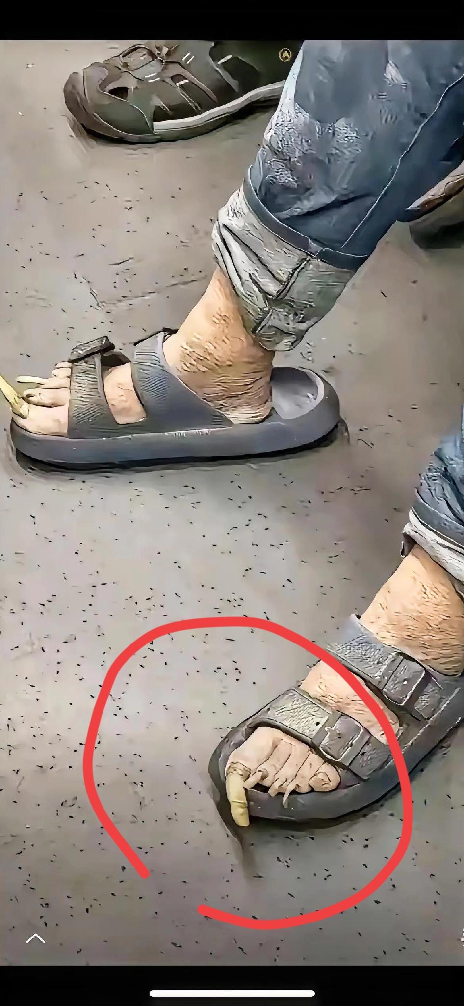 在拥挤的公共空间里，这双脚的“独特”让人心头一紧。厚厚的趾甲、沧桑的皮肤，或许藏