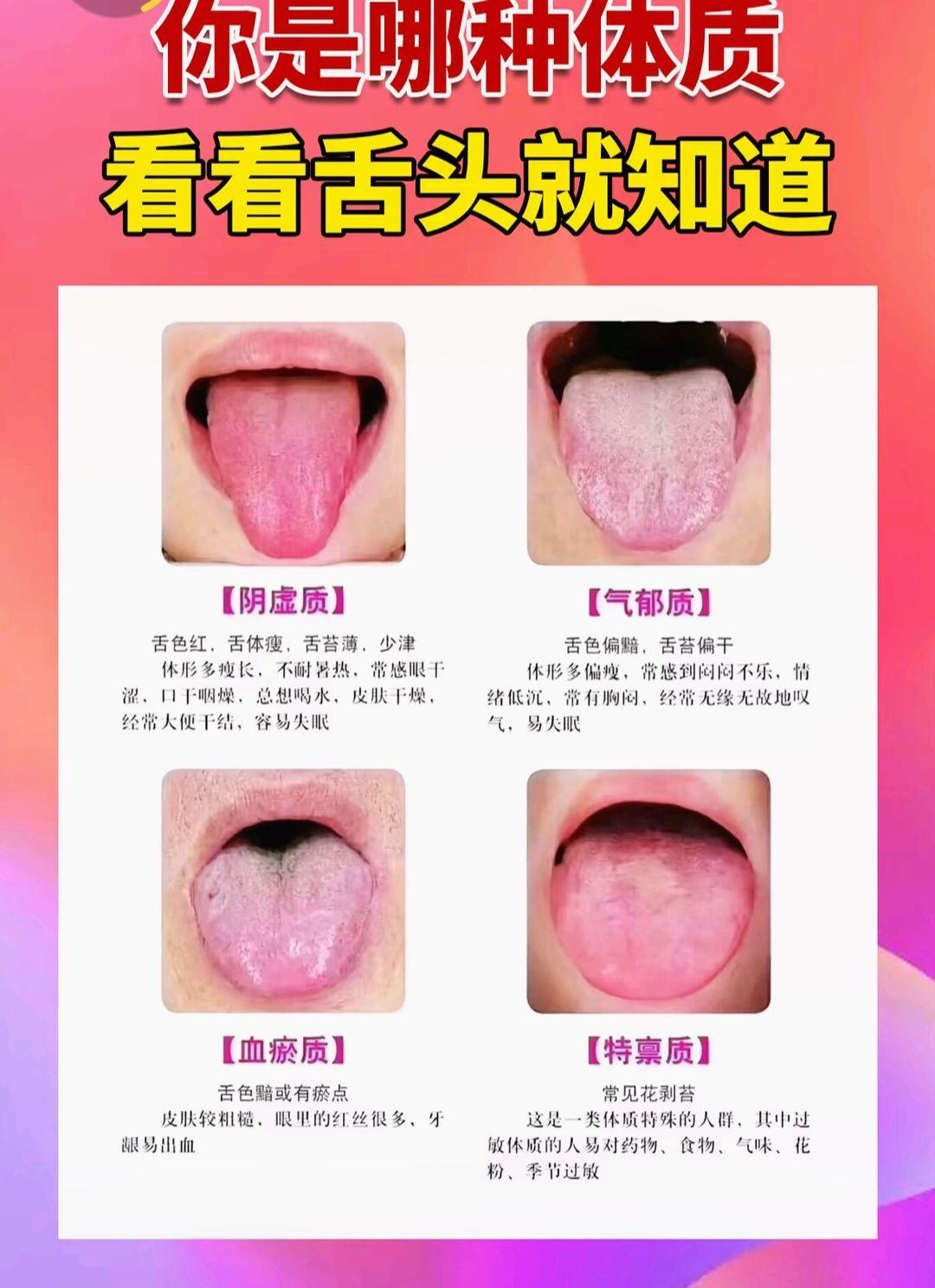 又到了每天健康科普的时候了 每日养生小科普 舌头的健康知识科普 舌苔白...