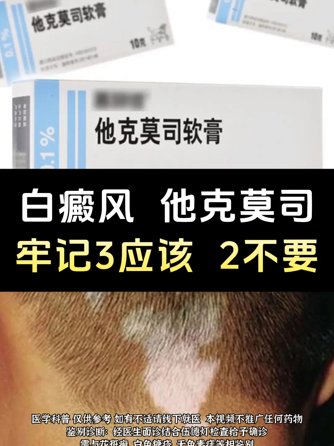 长期涂抹他克莫司，这几件事很重要。 ①用药前，用温水轻柔洗净白斑处，轻...