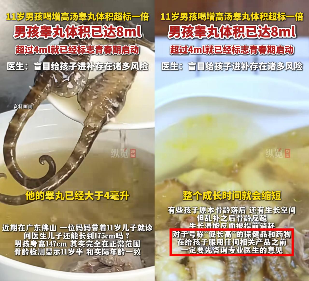 担心的事情还是发生了！
 
广东佛山一位妈妈怕11岁儿子

长不到175，天天炖