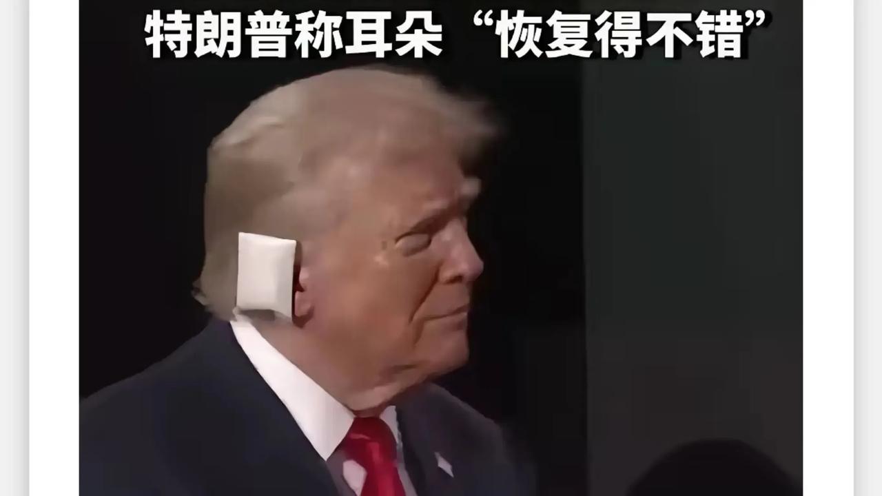 特朗普的右耳缠着厚厚的纱布，这没有让他停下竞选的脚步。他如期出席了共和党全国代表