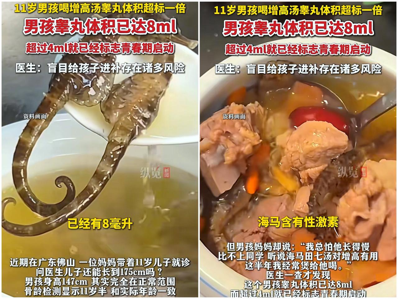 担心的事情还是发生了！
 
广东佛山一位妈妈怕11岁儿子

长不到175，天天熬