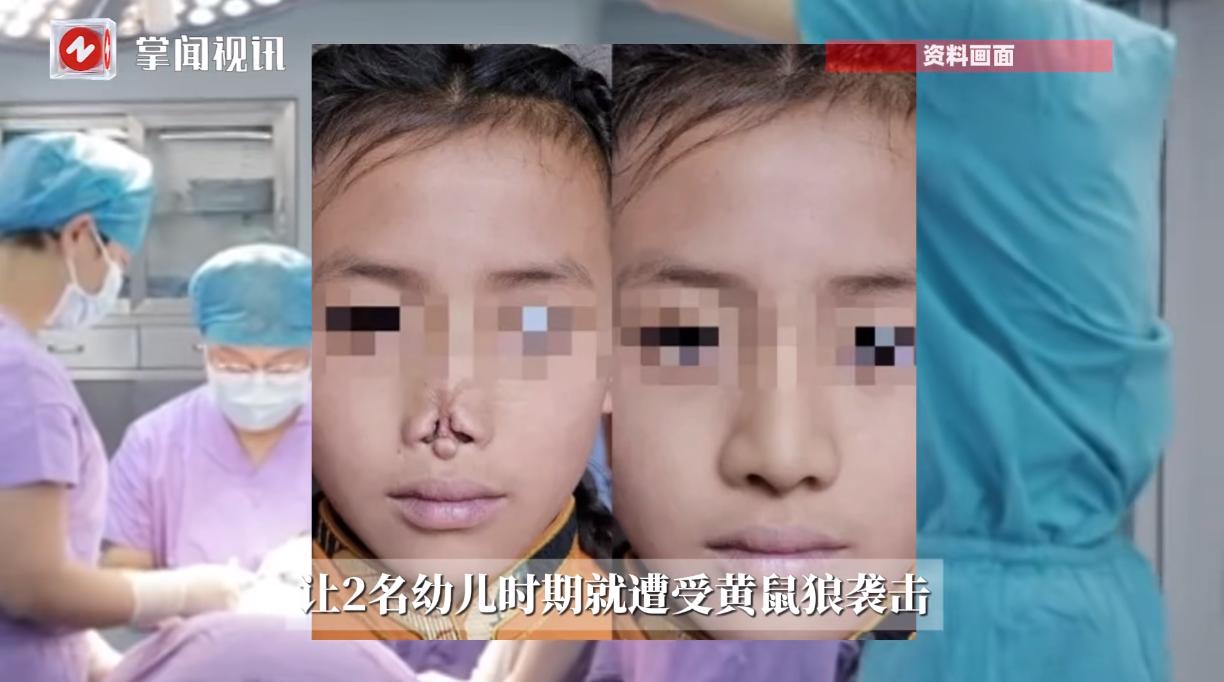“这才是真正的专家！”四川甘孜，两名牧民的孩子因为小时候睡觉时，父母没有注意而被