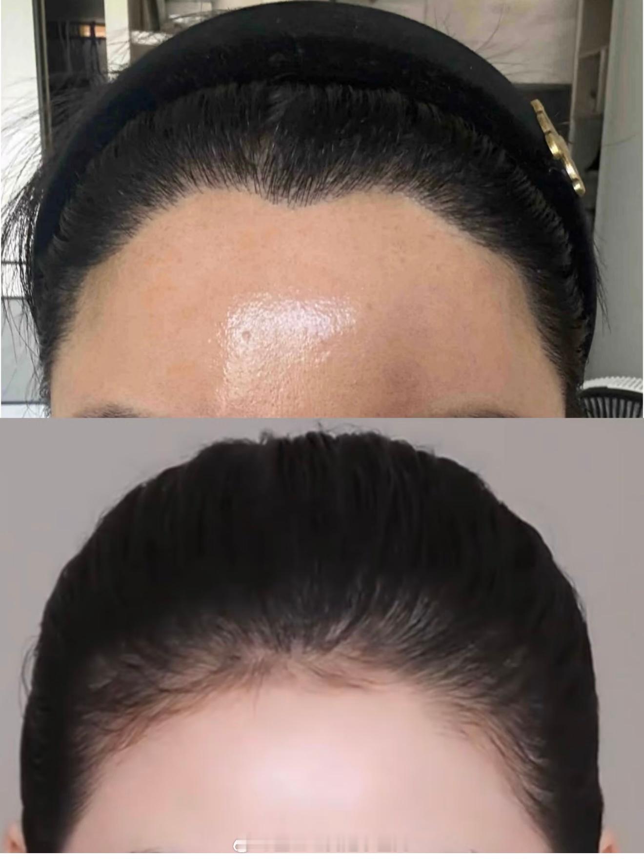 明天就要告别我的假发套喽 嘿嘿嘿 