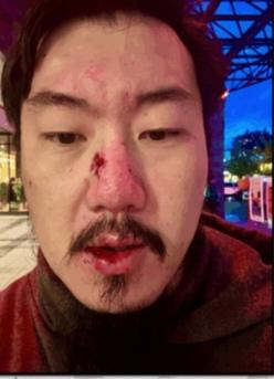 “没人能救得了你！”加拿大商场里一句话，华人爸爸被摁地狂揍60下，抓了又放，谁还