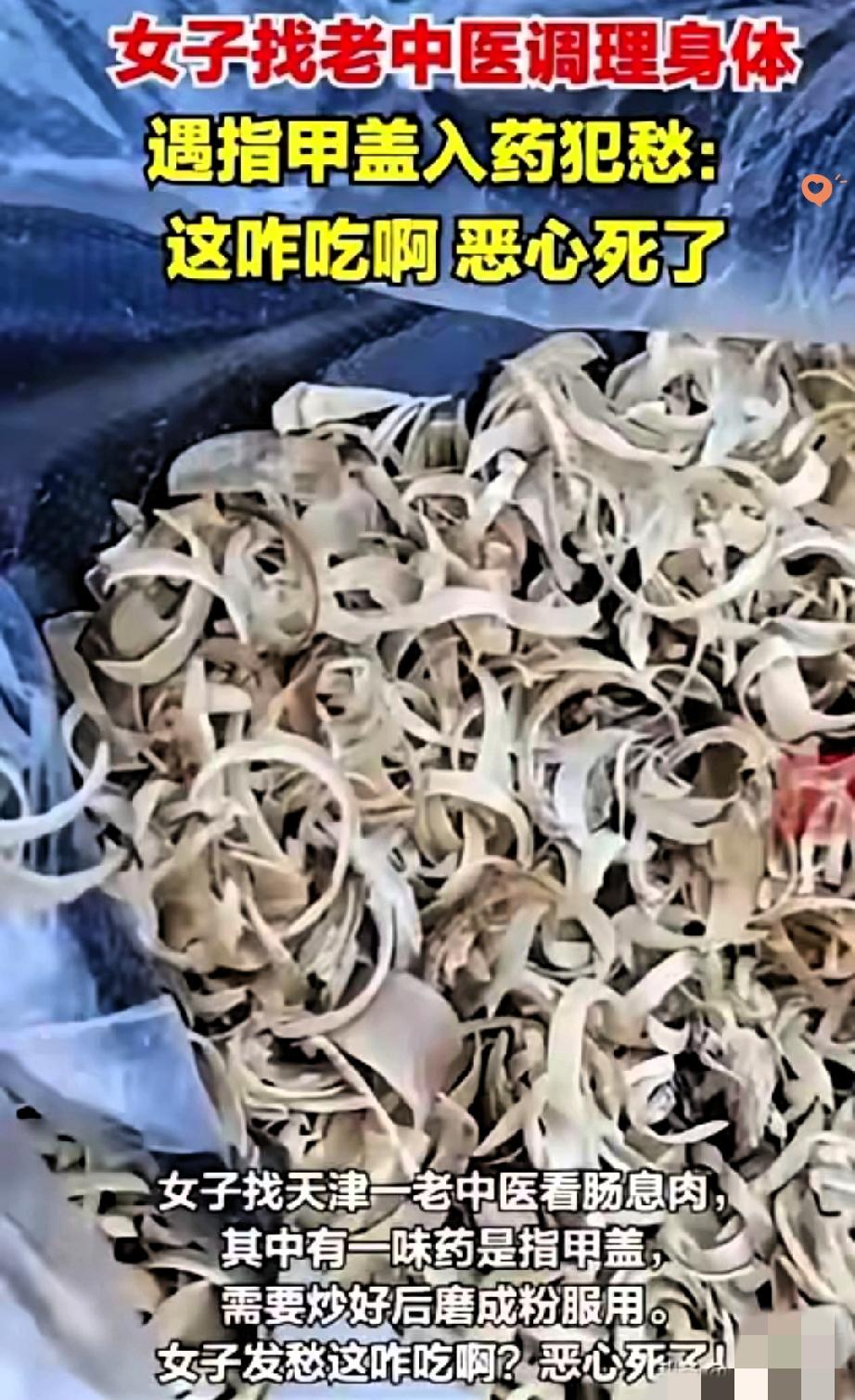 看着都反胃！
天津女子调理身体，药方里竟有带指甲油的指甲盖，换谁都得犯膈应。
 
