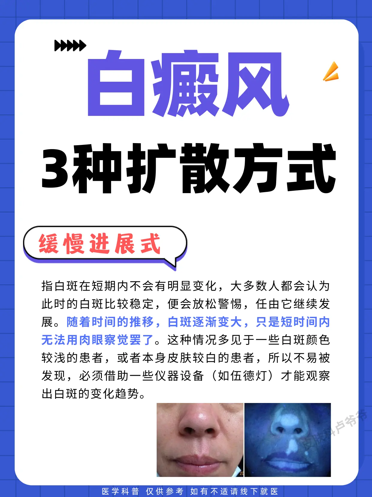 医学科普 白癜风 白癜风科普 硬核健康科普行动  白斑