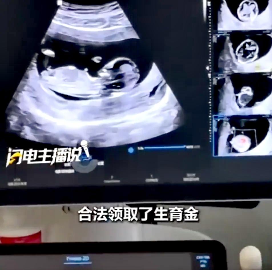 “聪明过头了！”9月13日报道，一女子刷到“流产后可申领生育保险基金”的信息，她