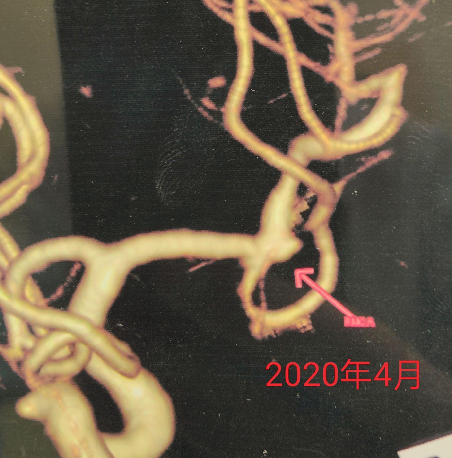 医生日常 医学科普 医学影像