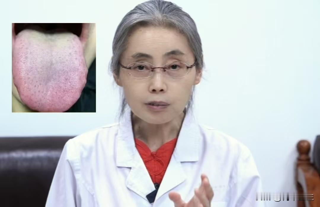 看见舌根黄腻，舌前发红就认为是下焦湿热加阴虚？大错特错，其实真正的病根在气虚
