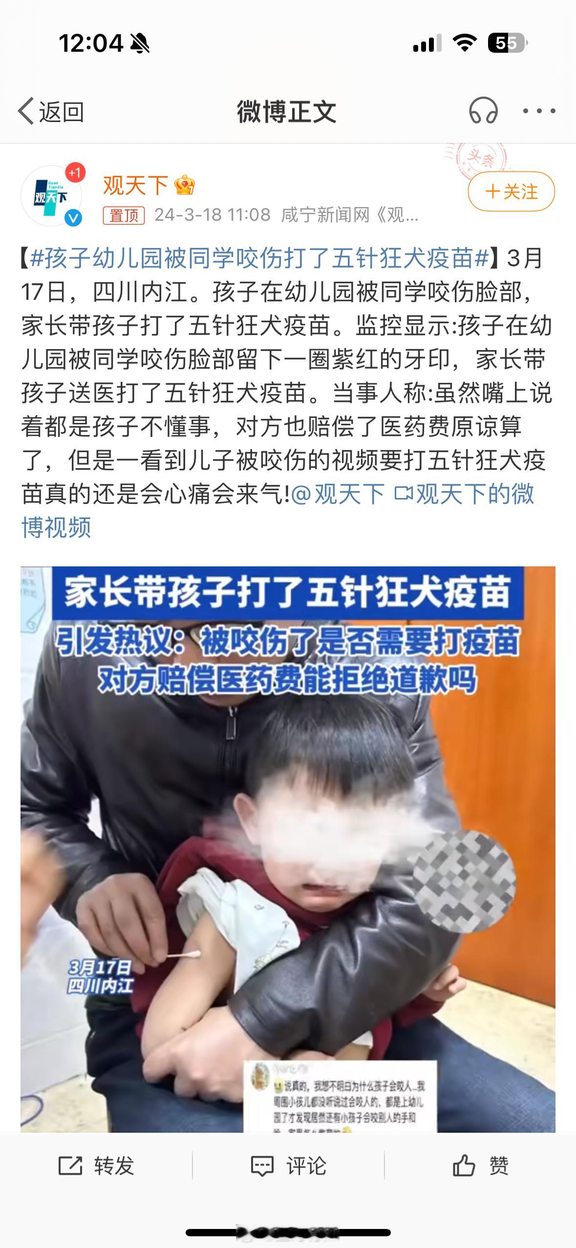 #孩子幼儿园被同学咬伤打了五针狂犬疫苗# 这种咬伤完全没有必要打狂犬疫苗，评论里
