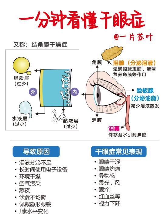 干眼症自救指南✅熬夜党必看‼️