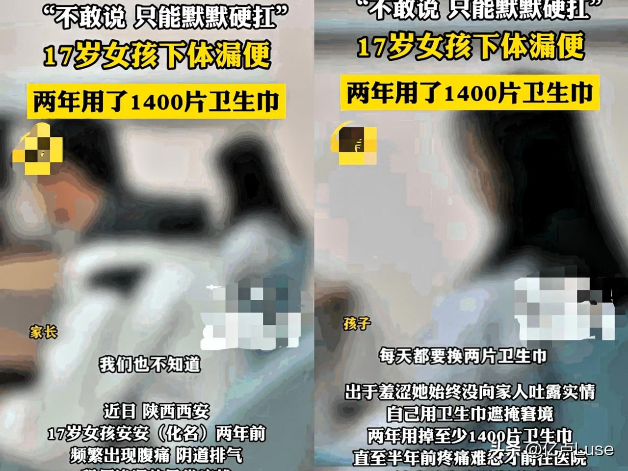 刚看到西安这个新闻，心疼这个女孩。
西安一名高二女生患直肠阴道瘘，下体漏排泄物，