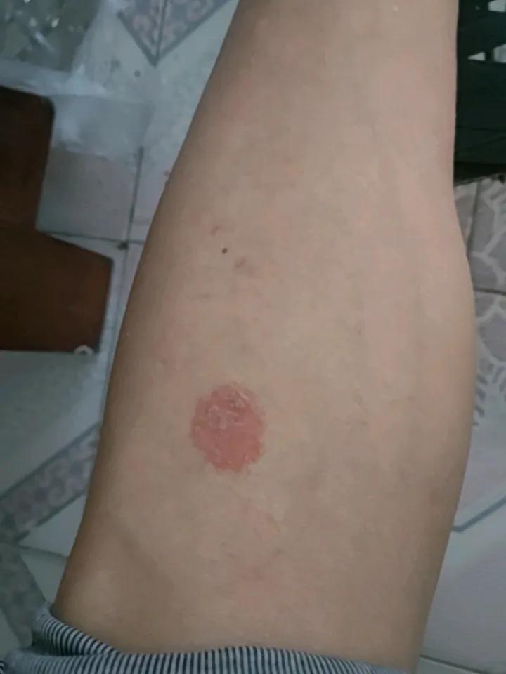 各位朋友请给看一下，这是什么病？是什么原因引起的？