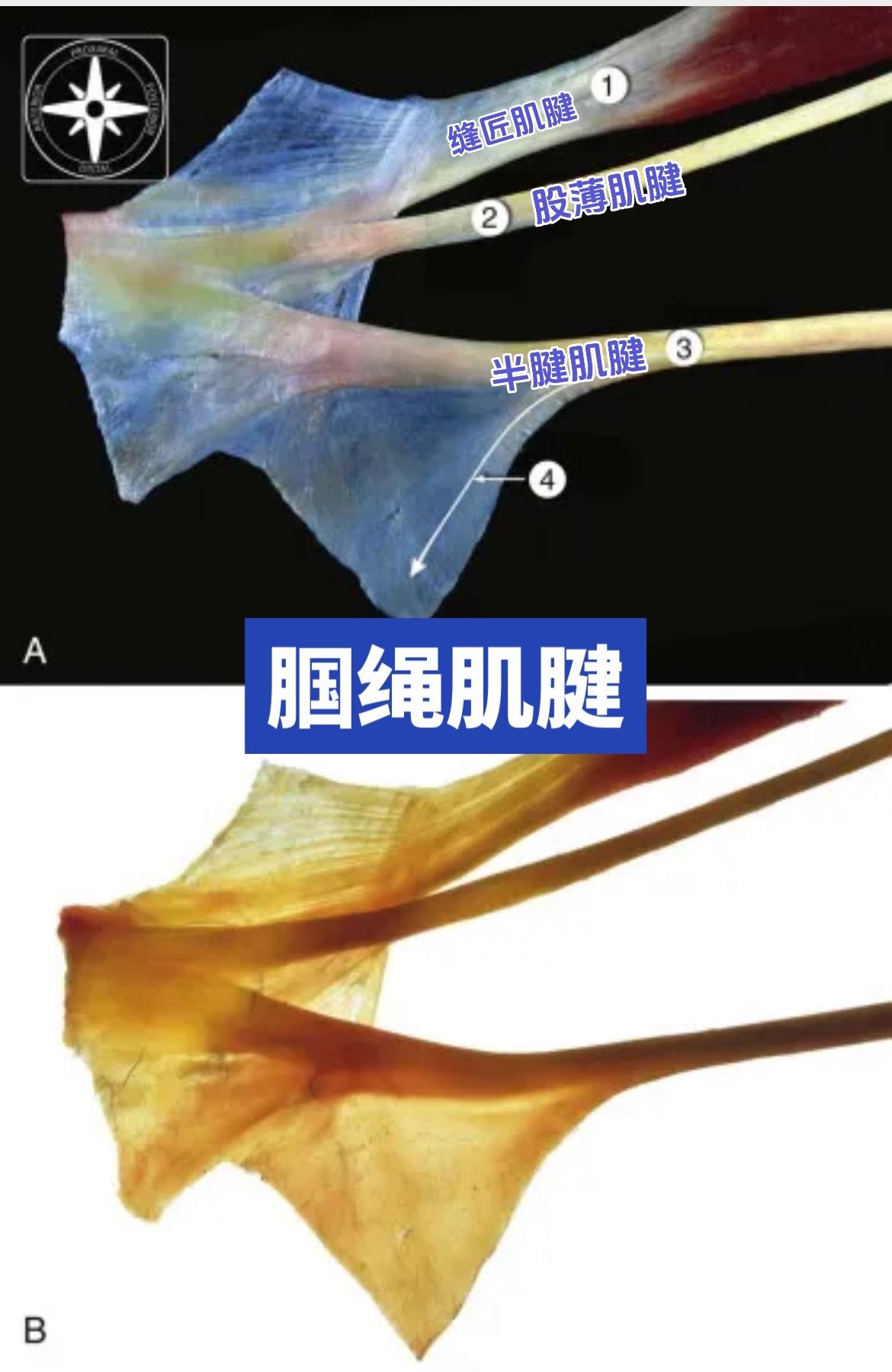 腘绳肌：ACL重建的"黄金替补"🏆。作为自体移植物的首选。它的优势...