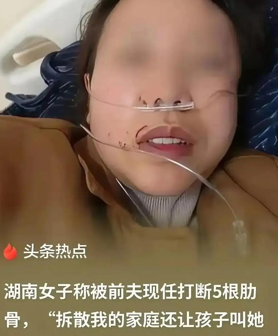 前妻被打断5根肋骨，亲夫在旁冷眼旁观：这才是婚姻里最让人胆寒的真相

家人们，湖