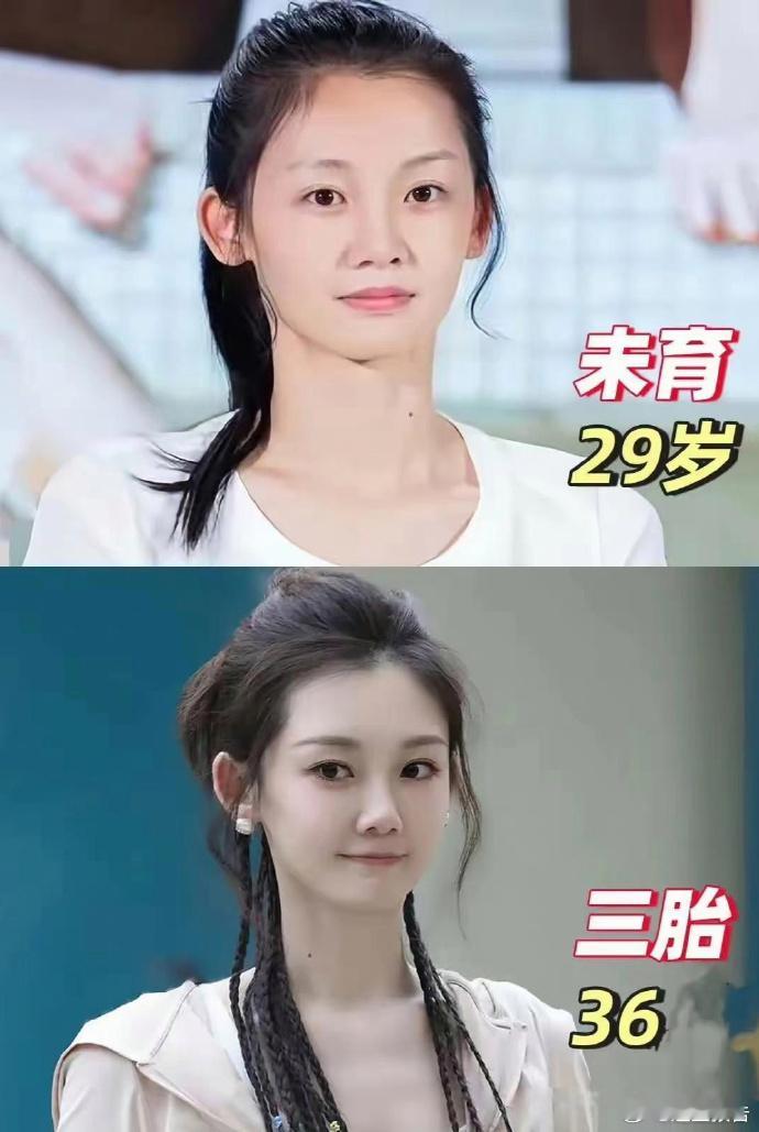vocal，这就是频繁生育的代价吗...... ​​​