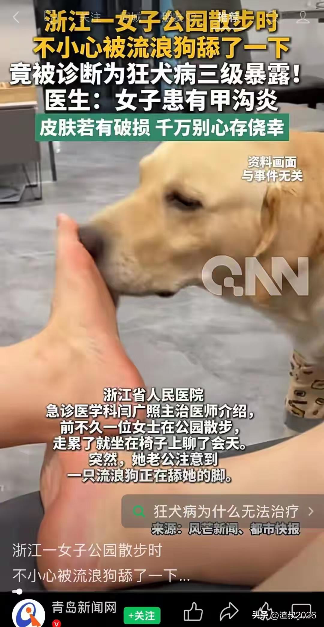 太吓人了！浙江杭州，一位女生晚饭后，在公园散步时被流浪狗舔了一下脚，就直接被判定