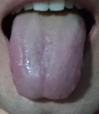 宗筋虚弱不振，根源在血虚血瘀，中医通调气血调理







很多男同志出现功能