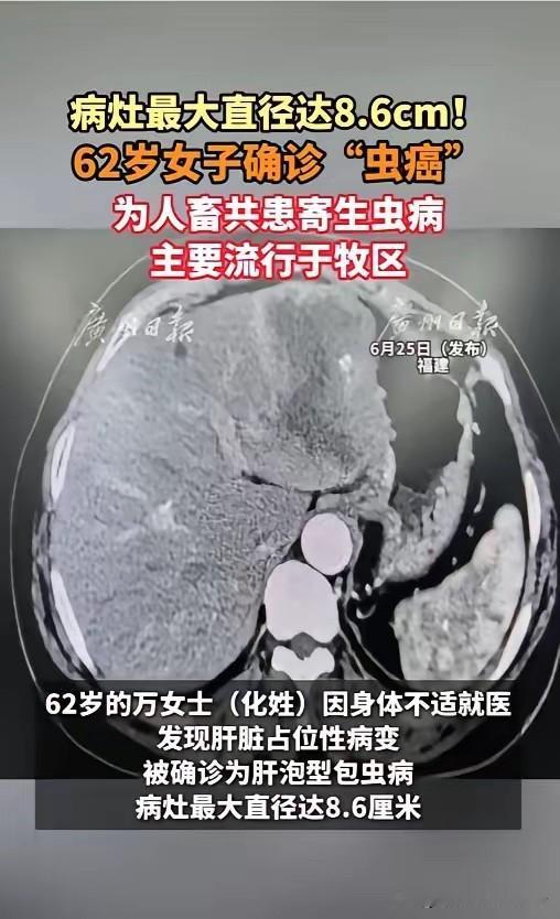给所有养宠家庭敲醒警钟！福建福州62岁的万女士，常年和自家宠物零距离相处，一直没