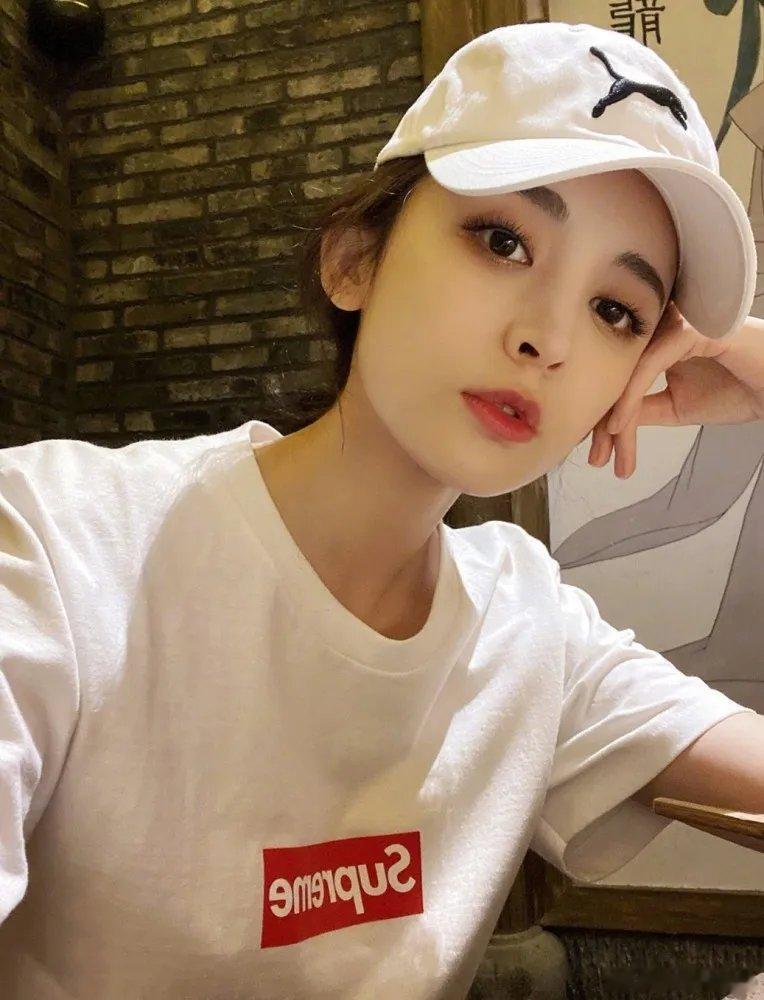 娜扎眼睛问题可能是小时候留的病根娜扎自曝眼睛问题困扰多年，医生称可能是小时候留下