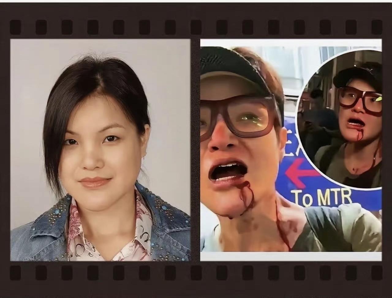 当时香港“黑暴”，爱国艺人马蹄露被当街暴打，缝了十一针！被各种围堵，失业不得不到