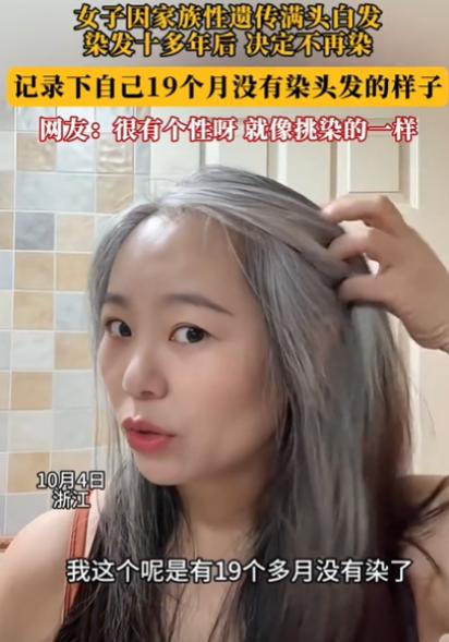 浙江一女子发现几根白发，她本以为拔了就是！万万没想到，仅仅几个月时间，她原本光亮