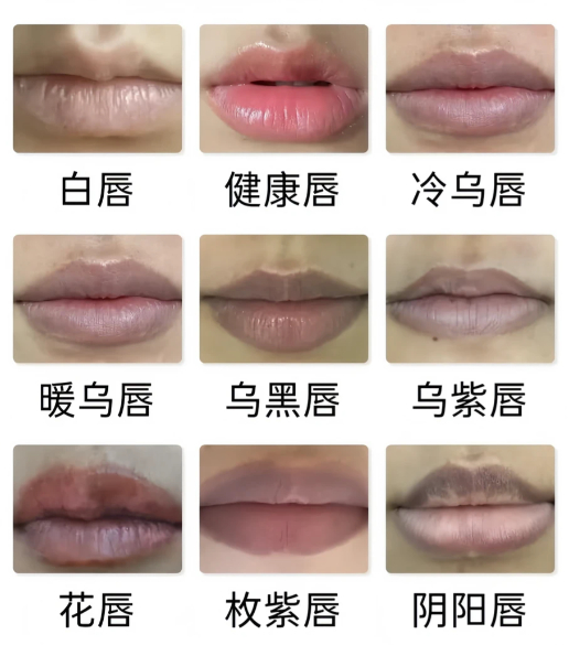 嘴唇发紫 心脏不好 像我们这种气血不足的，只会嘴唇发白