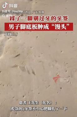 悲剧还是发生了！广东深圳，一男子饭后用牙签剔牙，之后顺手把牙签一扔，一个没注意就