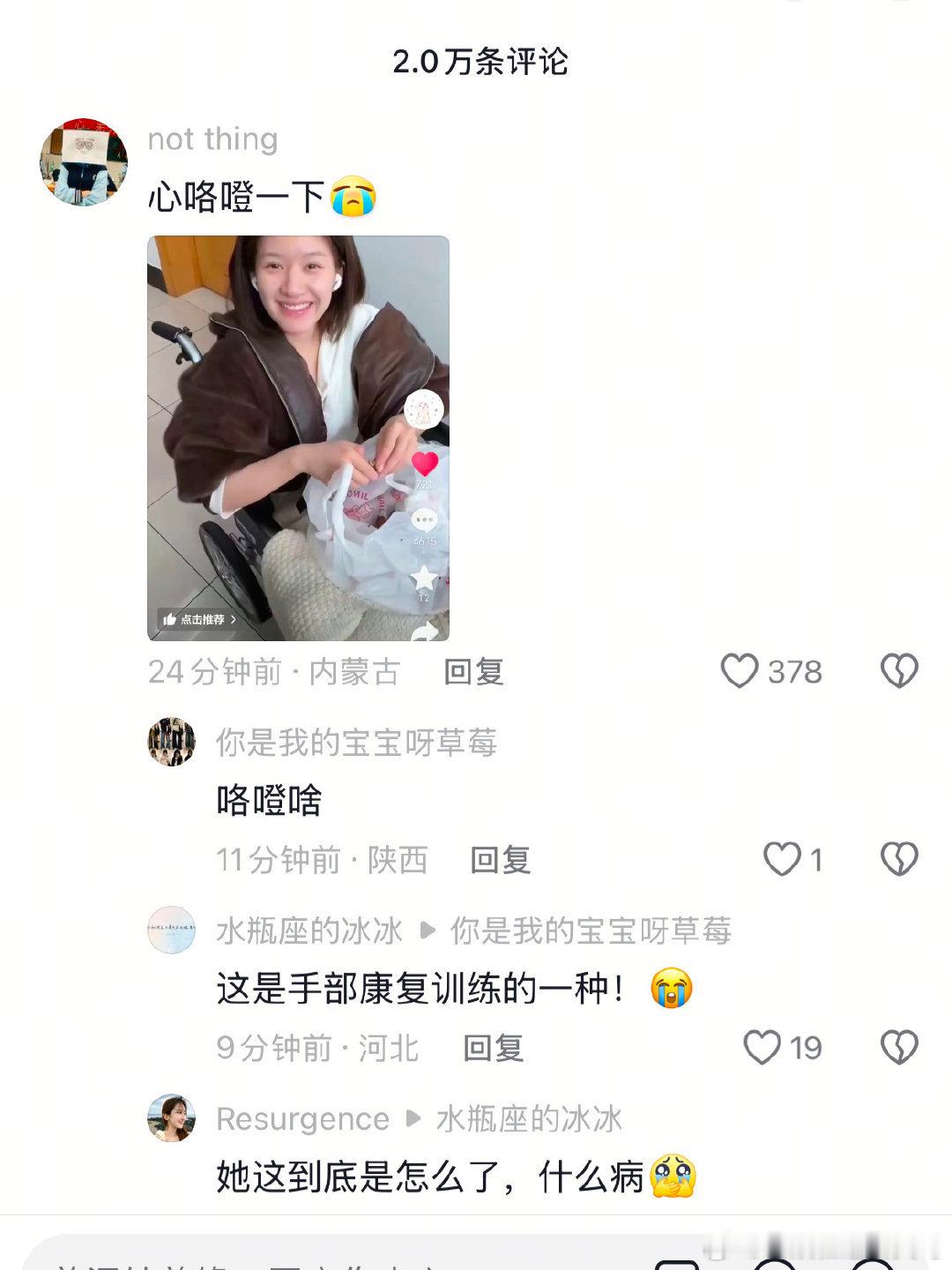 赵露思剥栗子原来是在做手部康复训练 赵露思剥栗子原来是在做手部康复训练！  