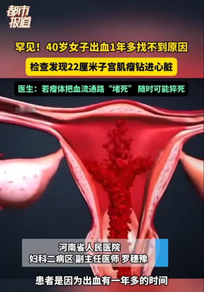 太震惊了！河南的一位40岁的女子，因月经异常多次就医，然而一直未能查出病因。最终
