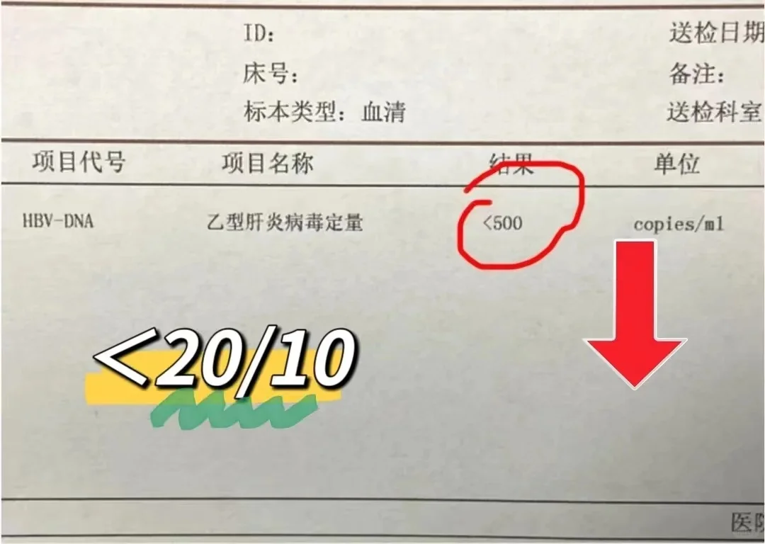 还认为乙肝病毒量低于500就安全了吗？