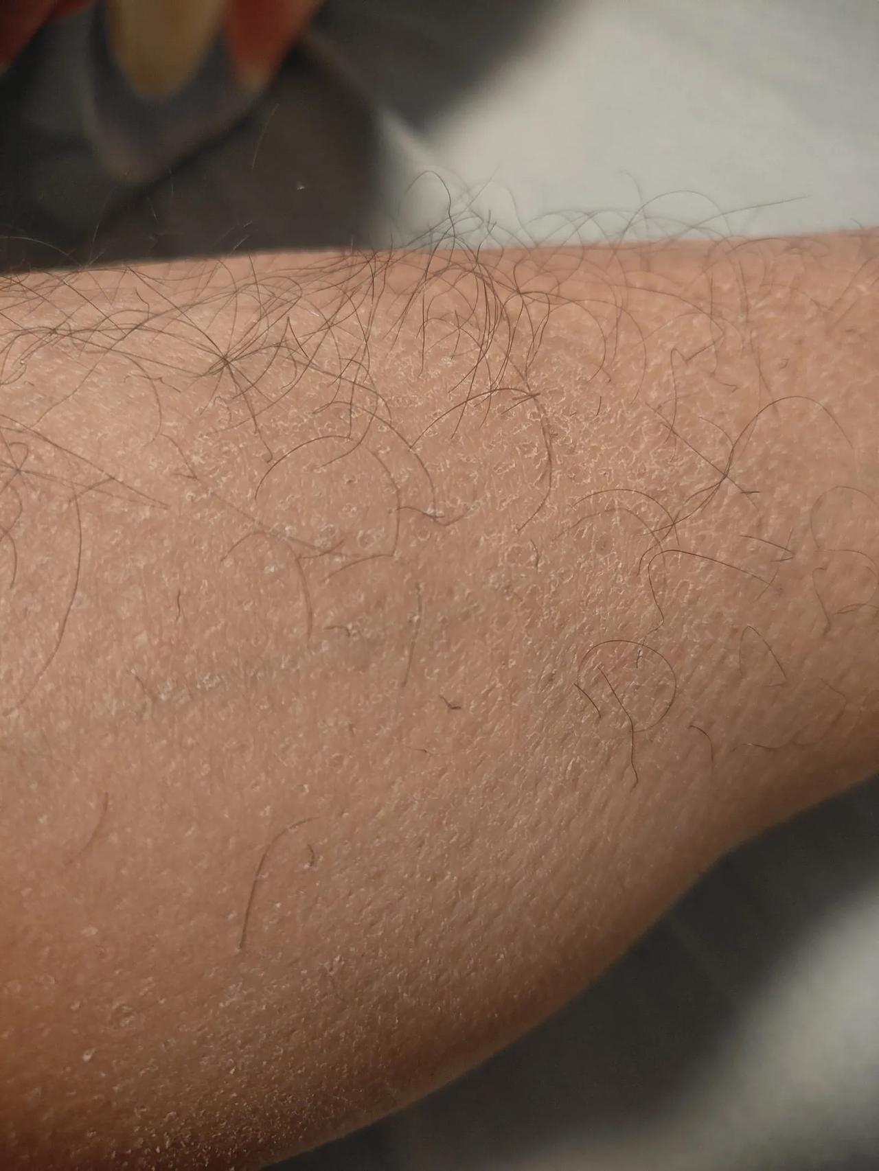 这篇文章算是一个求助的帖子！
我每年到了冬天皮肤就特别干燥，不仅看起来奇丑无比，