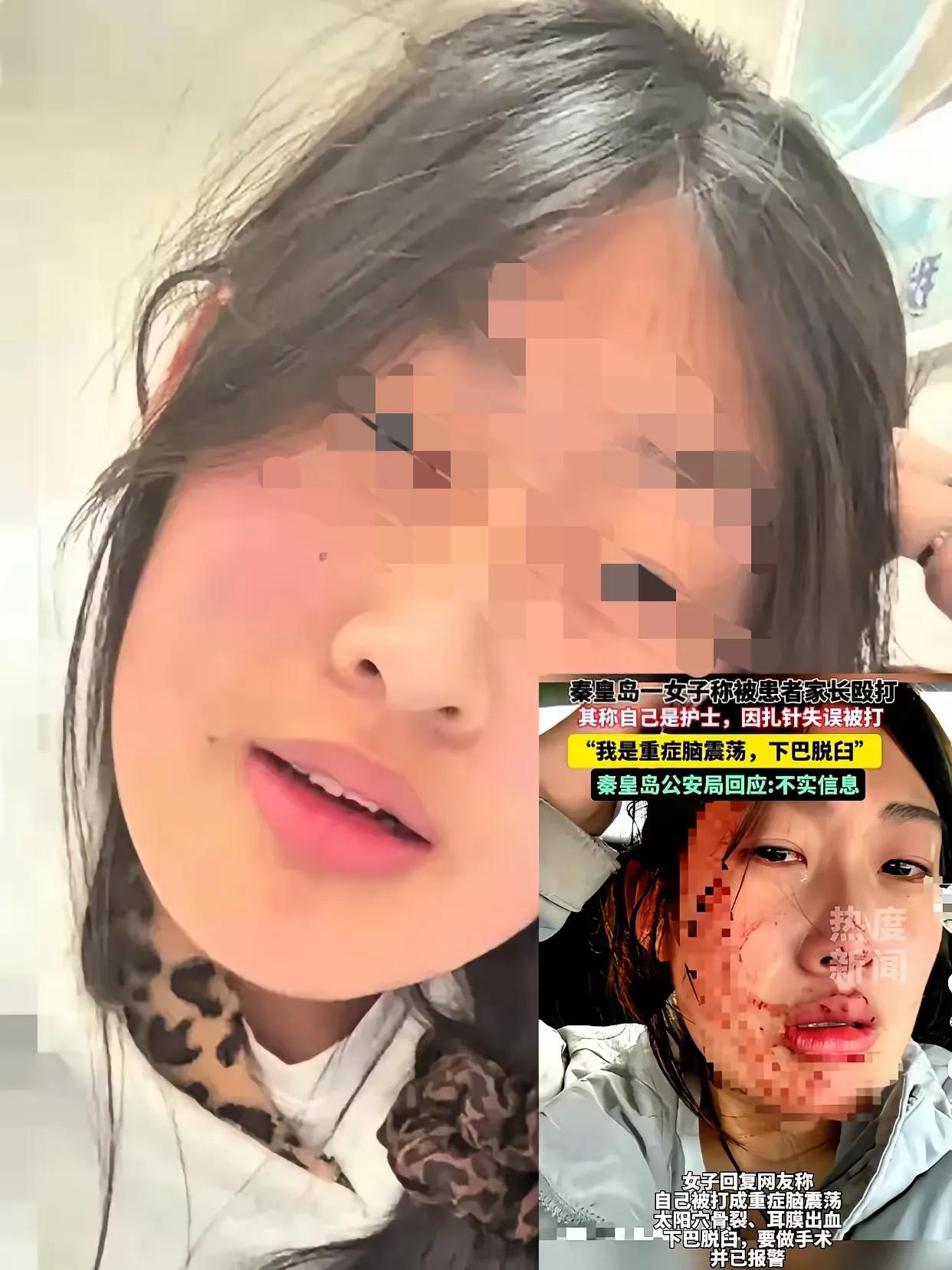 万万没想到！护士被打的事反转了，秦皇岛市第一医院明确否认发生此类事件，护士本人照