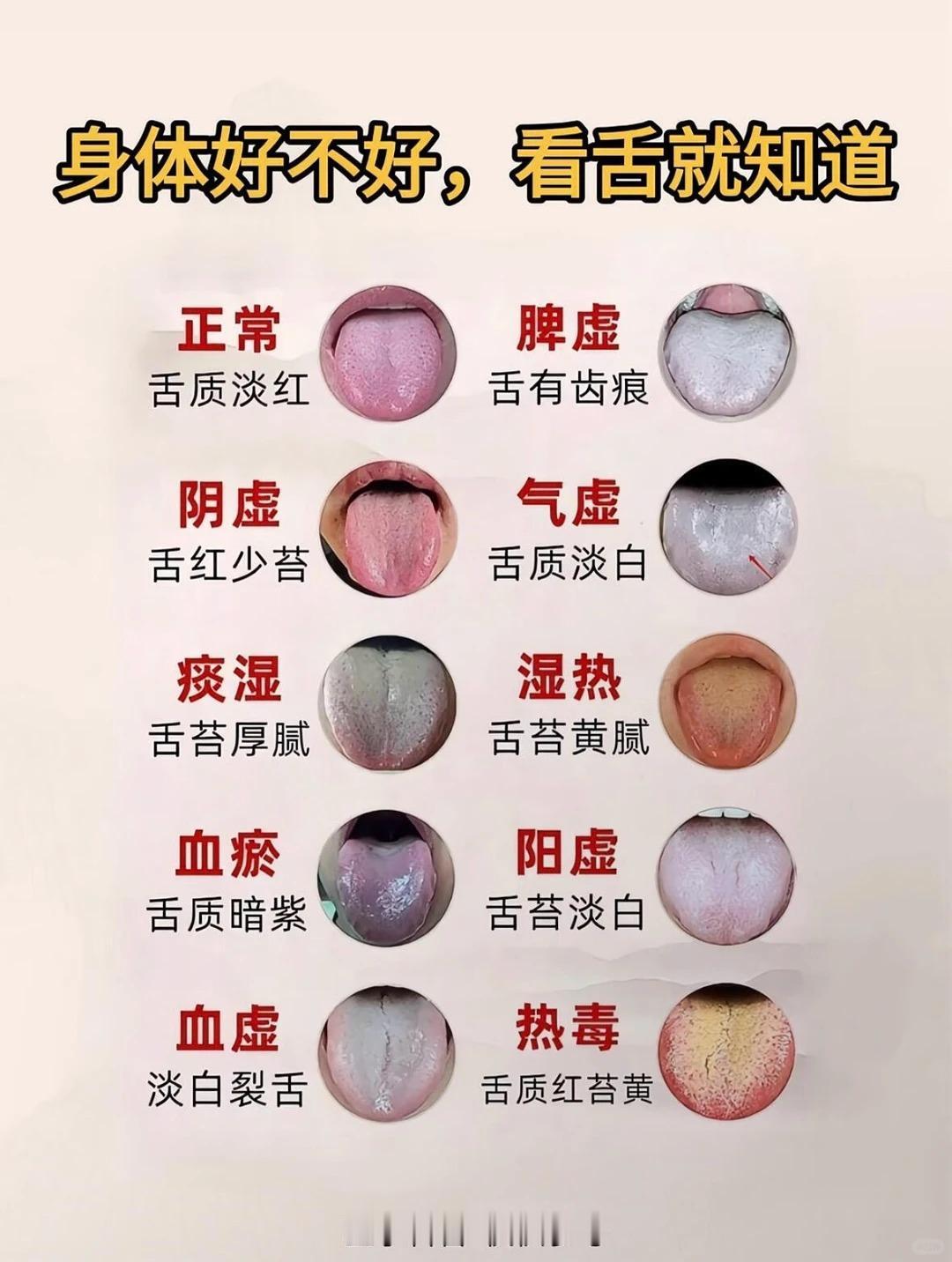舌头是身体的“晴雨表”，健康状况一看便知