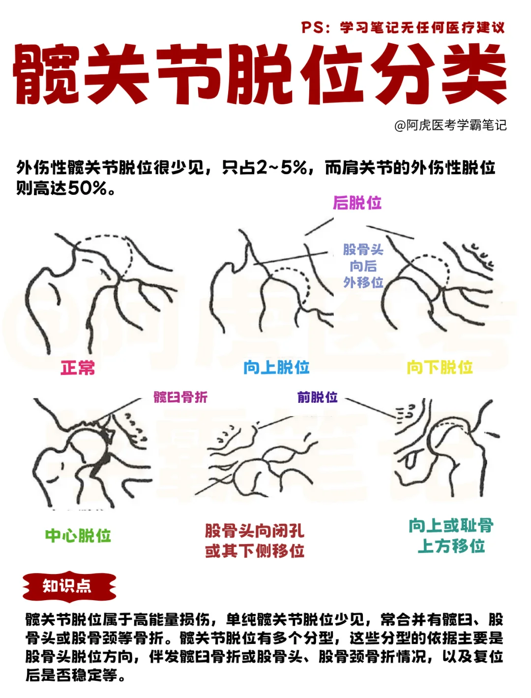 医学生笔记📒｜各种各样的骨折👆