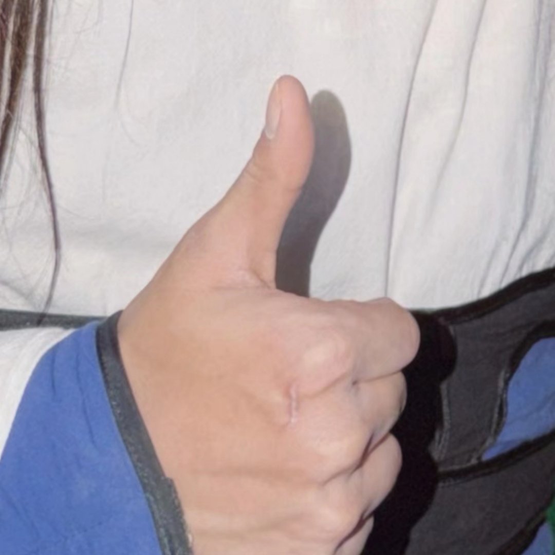 鱼鱼手上什么时候又添了一道疤 之前好像没注意到过… 