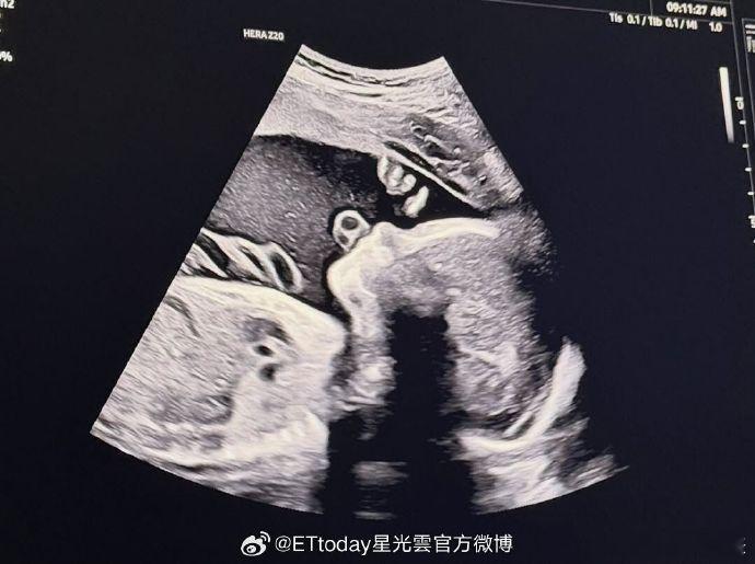 宋承炫当爸 恭喜！ 