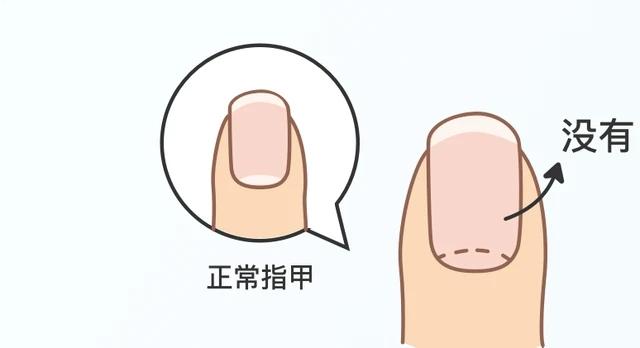 #健康真探社#【为什么有的人指甲上有月牙，有的人却没有？】指甲上这个月牙到底是什