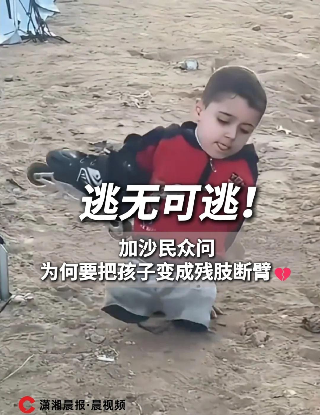 加沙民众问为何要把孩子变成残肢断臂💔
泪目...以军在加沙城的军事行动导致大量