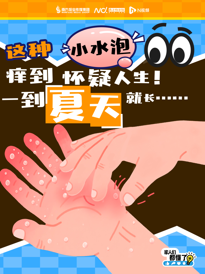 #三招预防汗疱疹#【痒到怀疑人生！很多人一到夏天就长……】每到天气热起来的时候，