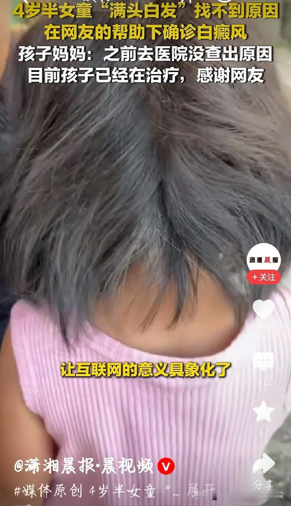 贵州毕节一位四岁半的女童，满头白发，家长一开始心里没底，发帖求助网友。在大家的热