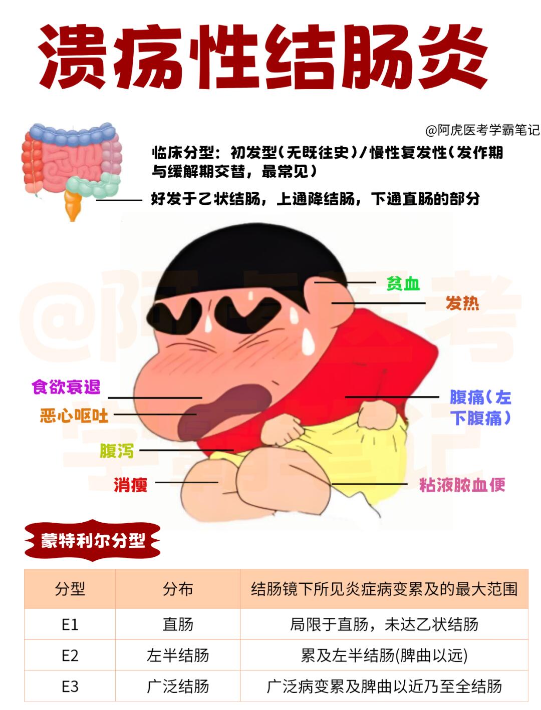 医学生笔记📒：溃疡性结肠炎👆