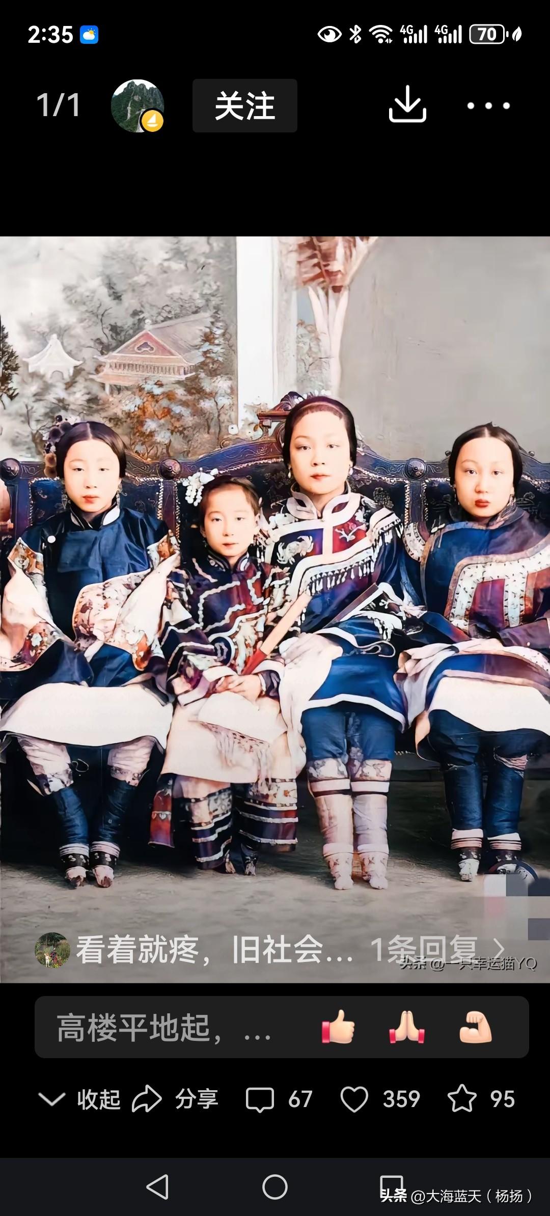 旧时代的产物
那个年代咱们的奶奶都是两只三寸金莲，走路脚后跟用力，都是外八字，这