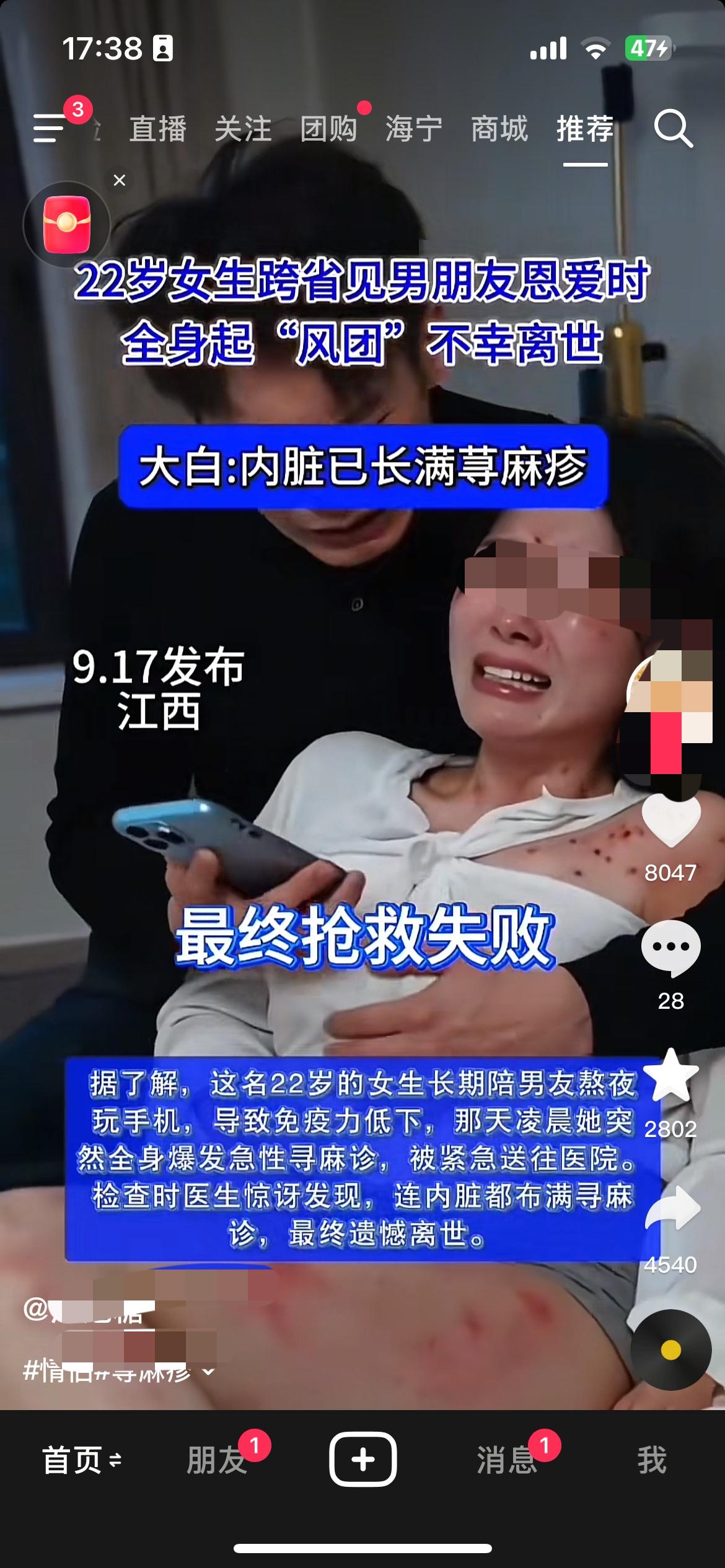 22岁的女生长期陪男友熬夜玩手机，导致免疫力低下，那天凌晨她突 2802然全身爆