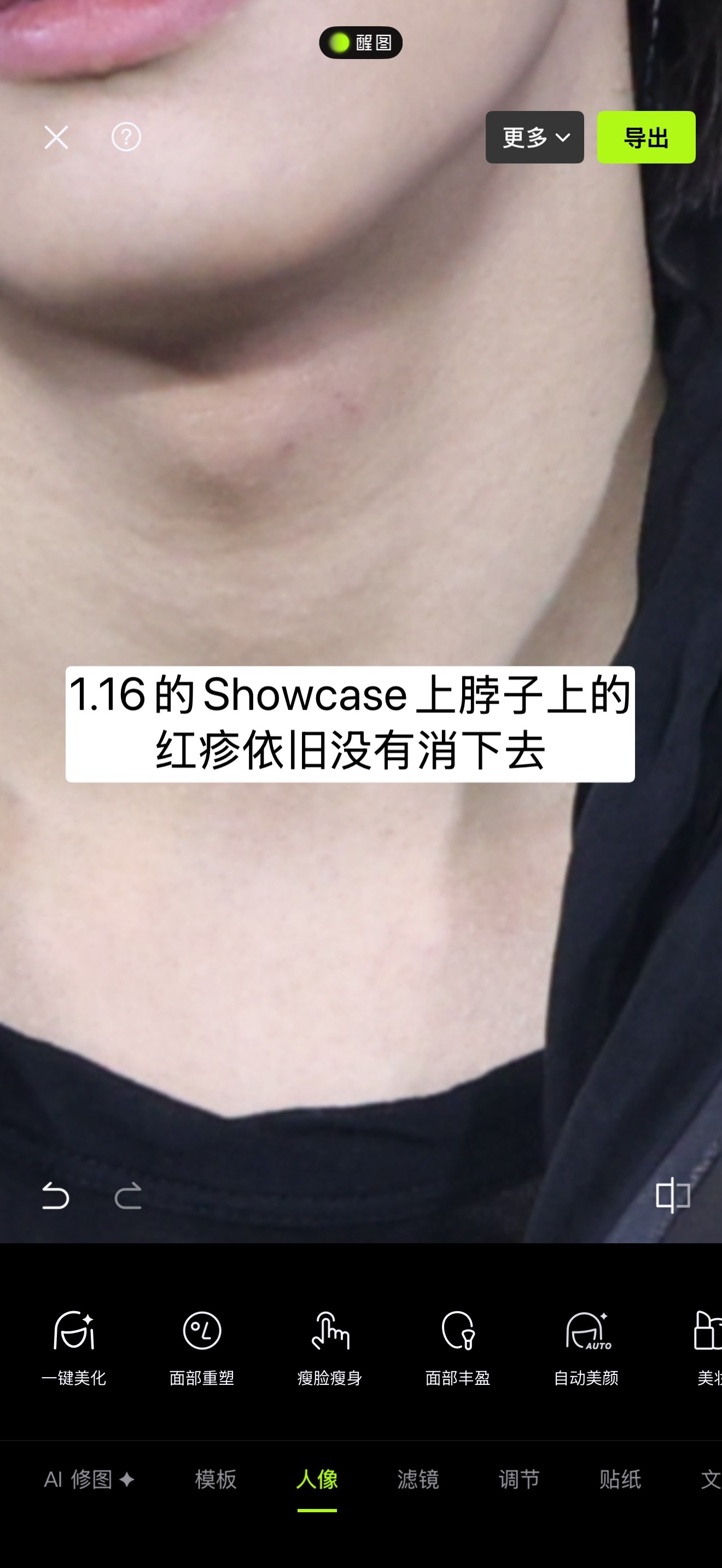 沈载伦澄清之前伦儿自己也讲过，如果说不吃维生素的话会免疫力降低，并且会伴有溃疡以